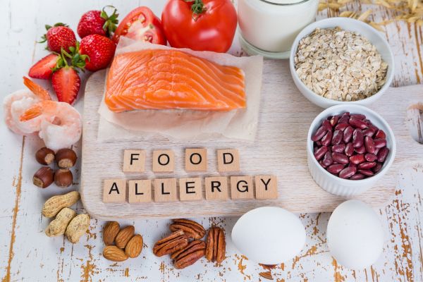 managing food allergies