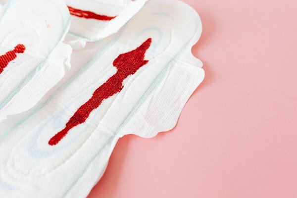 pcos and irregular periods